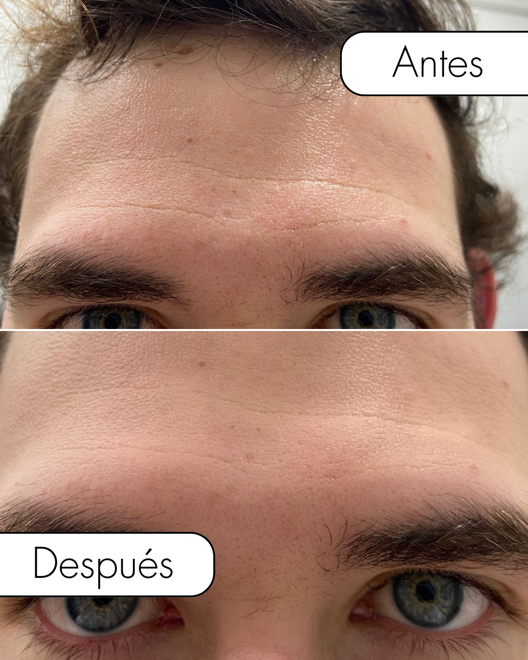 Kit: Depiladora + Serum Gold