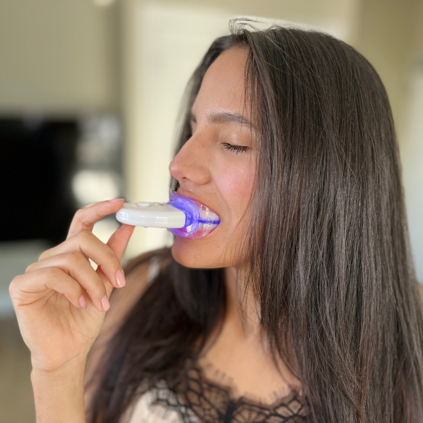 Blanqueamiento Dental