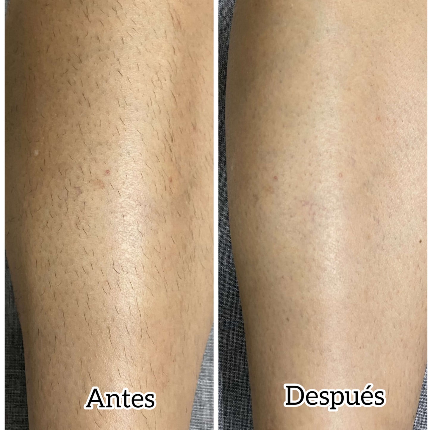 Kit: Rasuradora + Serum Gold