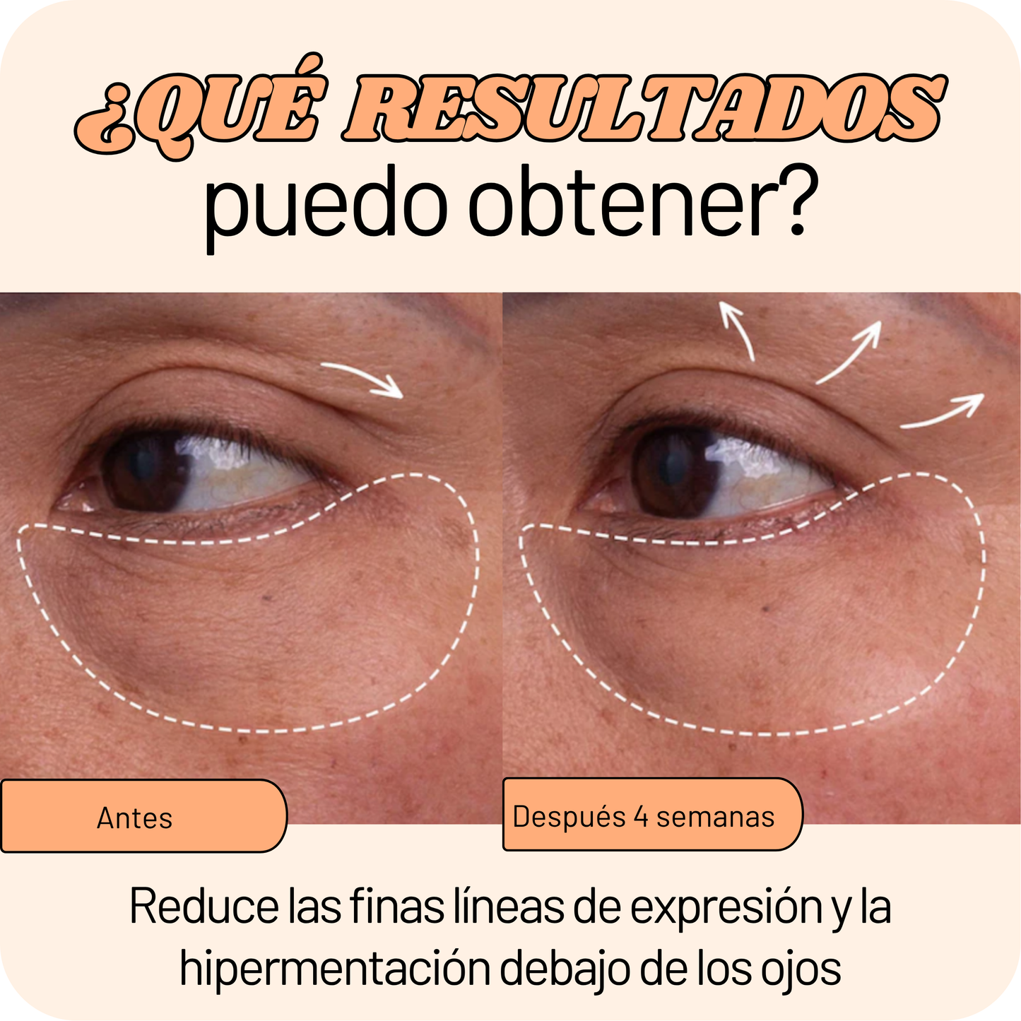 Kit Antiojeras: Magic Wand + Serum Gold + Eye Mask