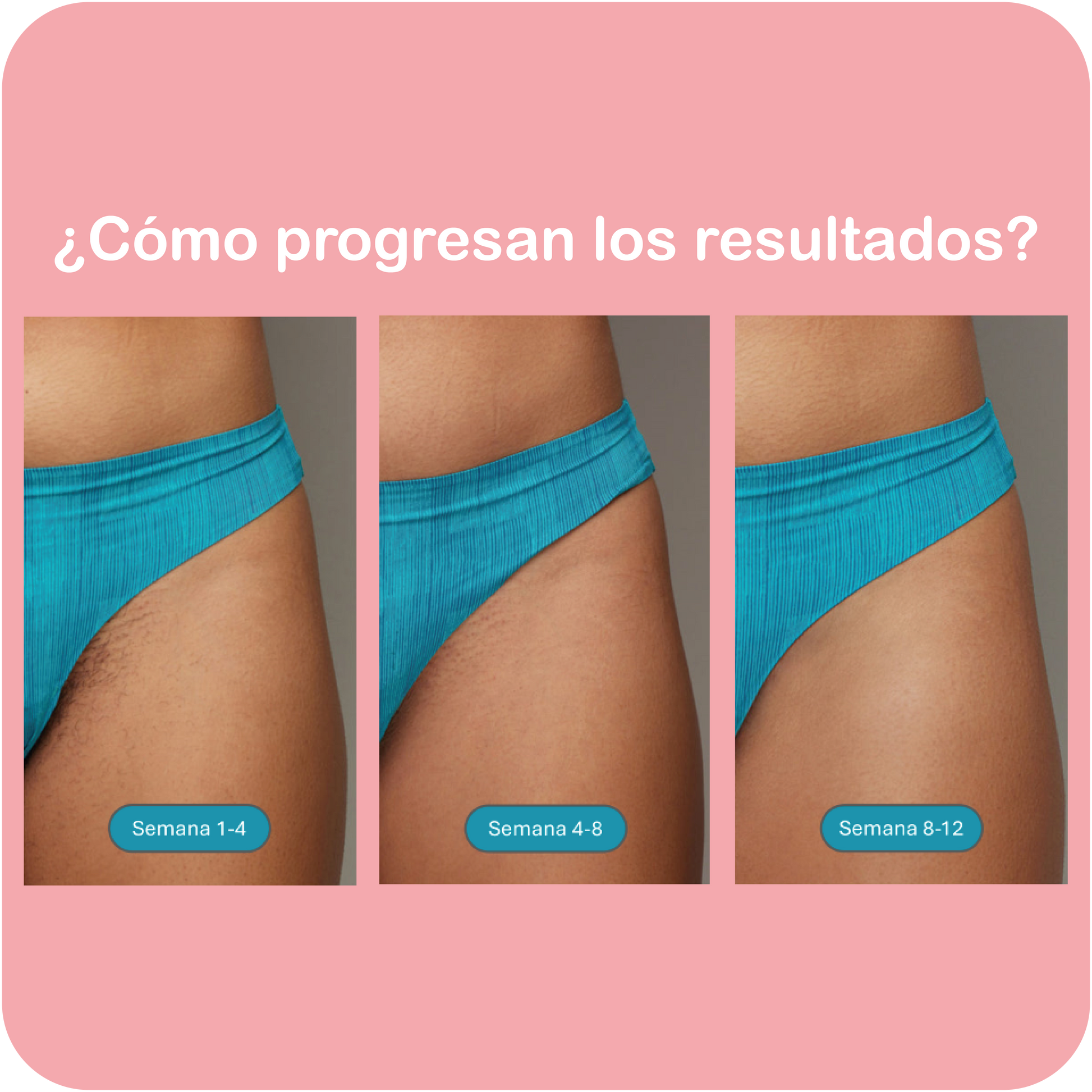 Depilación Ipl Como Me Depilo La Zona Del Bikini Depilacion Laser